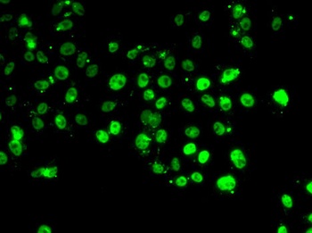 GABPB1 Antibody