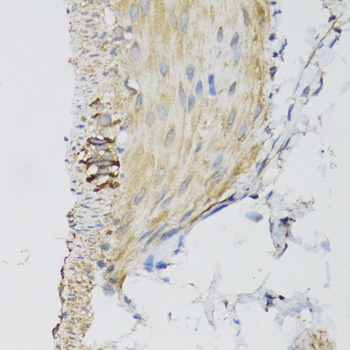 DGUOK Antibody