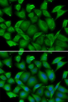 DEFA1 Antibody