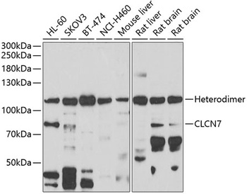 CLCN7 Antibody