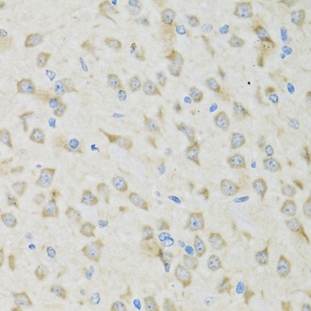 CLCN7 Antibody