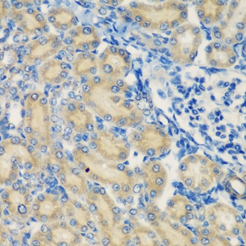 C1S Antibody