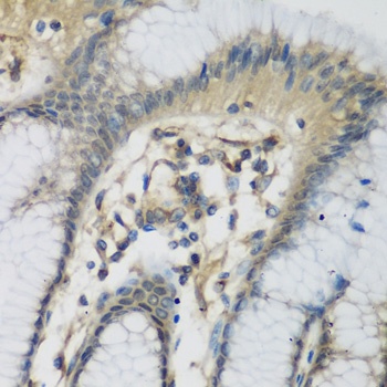 C1S Antibody