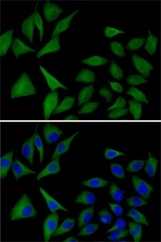 ATOX1 Antibody