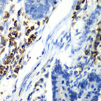 ASGR1 Antibody