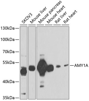 AMY1A Antibody