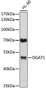 DGAT1 Antibody
