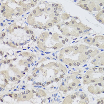 EIF2C2 Antibody