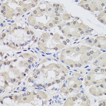 EIF2C2 Antibody