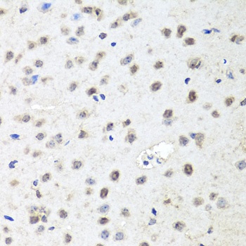 EIF2C2 Antibody