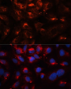 CPT1B Antibody