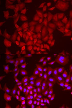 DCAF7 Antibody