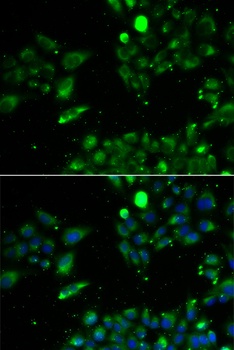 UQCRFS1 Antibody
