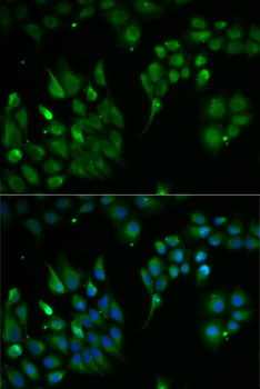 TXN2 Antibody