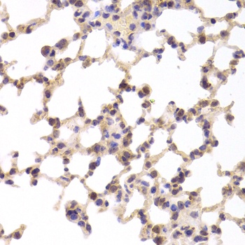 TSC22D3 Antibody