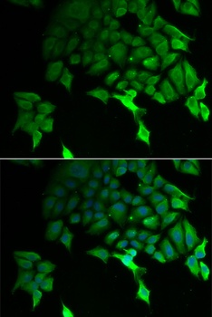 TSC22D3 Antibody