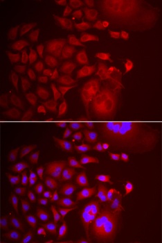 TRAPPC10 Antibody