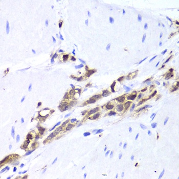 TPPP3 Antibody