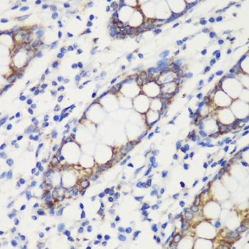 TOM20 Antibody