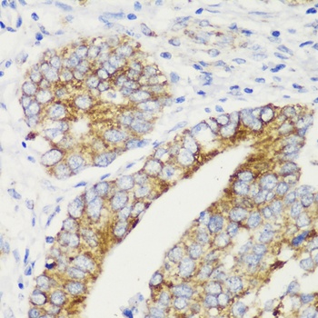 TOM20 Antibody