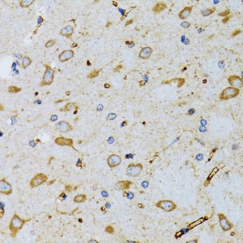 TOM20 Antibody