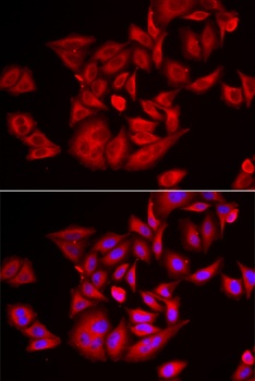 TLK2 Antibody