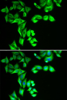 STRN3 Antibody