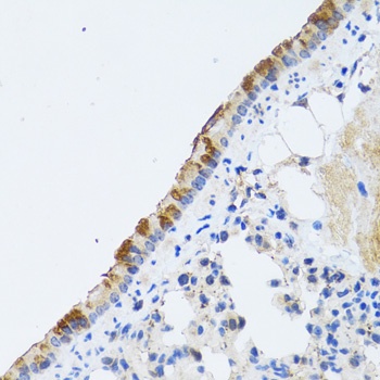 ST3GAL3 Antibody