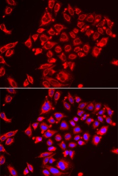 ST3GAL3 Antibody