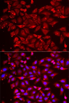 SRP19 Antibody