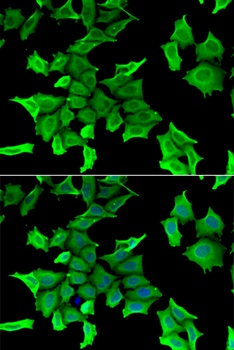 SPINT2 Antibody