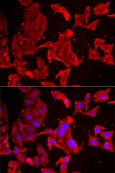 SMPX Antibody