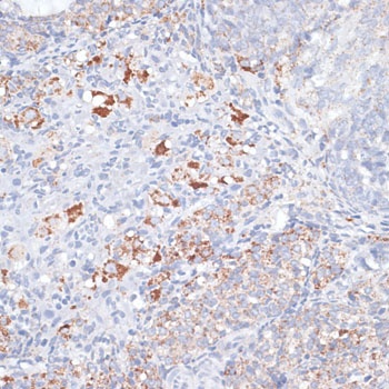 SMPD1 / ASM Antibody