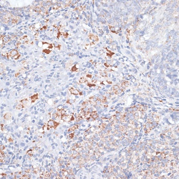 SMPD1 Antibody