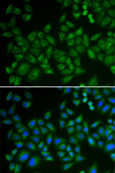 SMPD1 / ASM Antibody