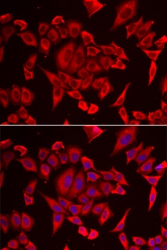 SLC20A2 Antibody