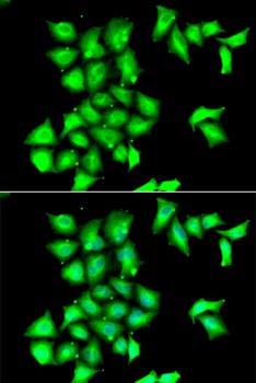 MSRB1 Antibody