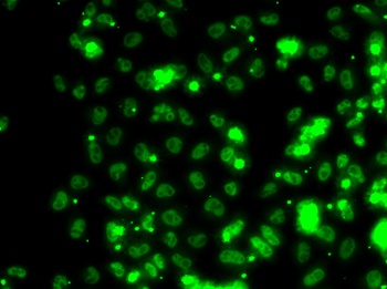 SECISBP2 Antibody