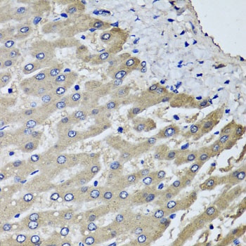 SCYL1 Antibody