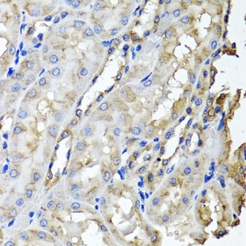 SCYL1 Antibody