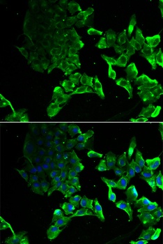 SCYL1 Antibody