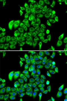 RPS7 Antibody