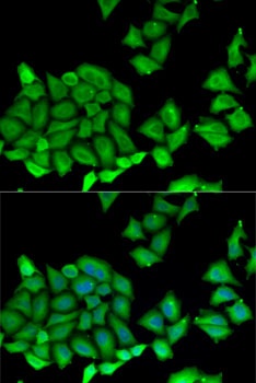 RPS7 Antibody