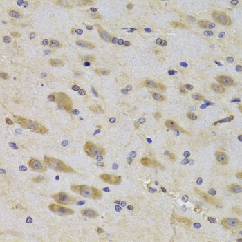 RPS27 Antibody