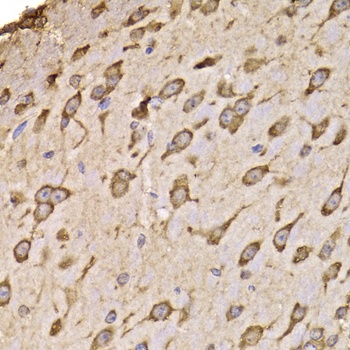 RPS14 Antibody