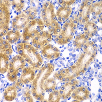 RPN1 Antibody