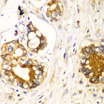 RPN1 Antibody