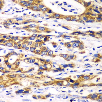 RPN1 Antibody