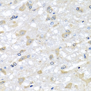 RPLP1 Antibody