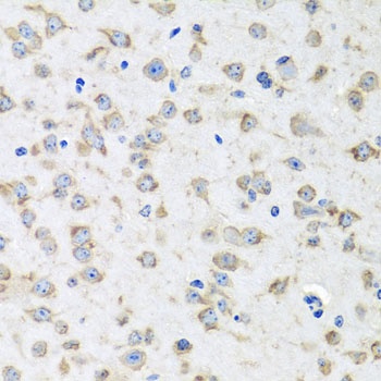 RPLP1 Antibody